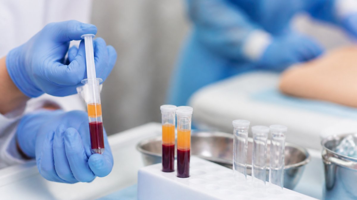 Stem Cell Therapy for Joint Recovery: 2026 Guide
